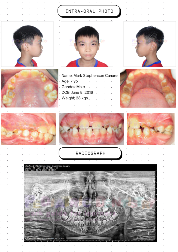 Case 1 – Pediatric Dentistry Workbook